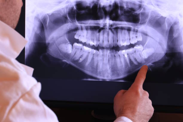 Best Orthodontic Emergency Dentist in Anna, OH